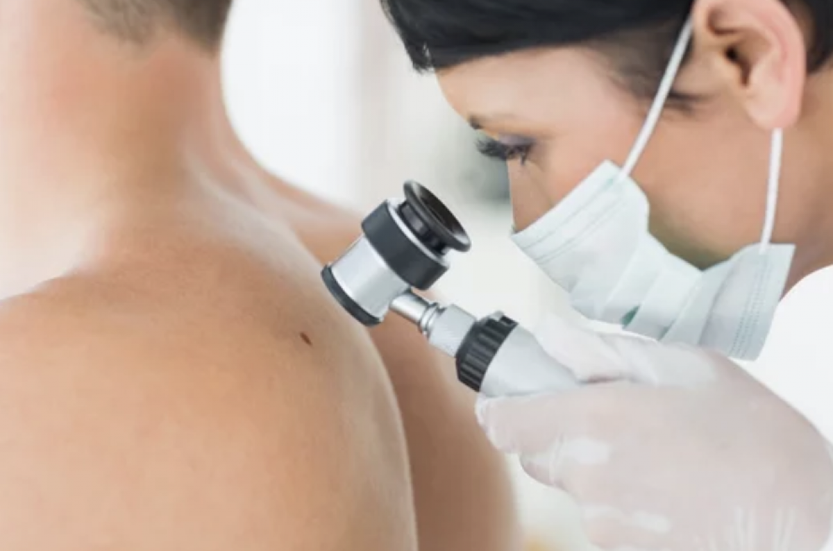 Klaipėdos SG klinika nemokamai tikrins dėl odos vėžio