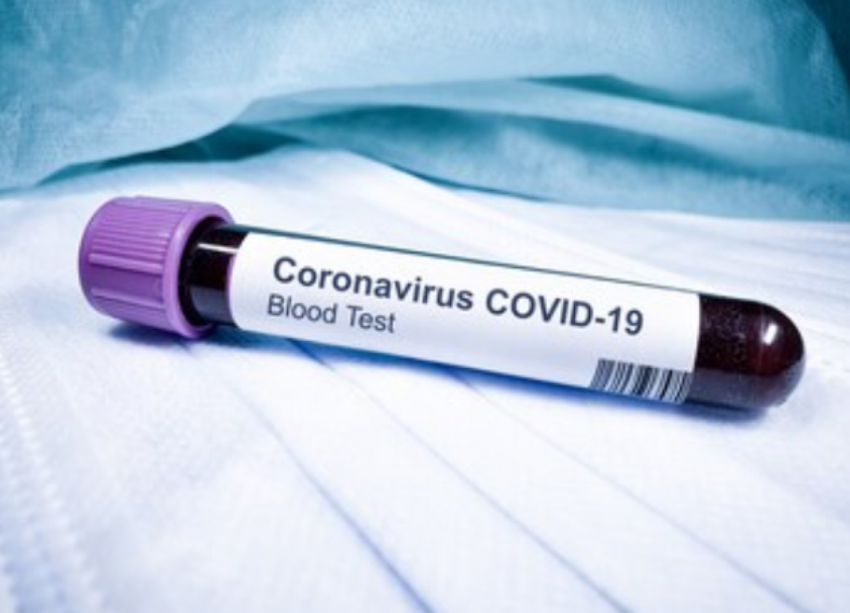 Koronavirusu užsikrėtė kretingiškis