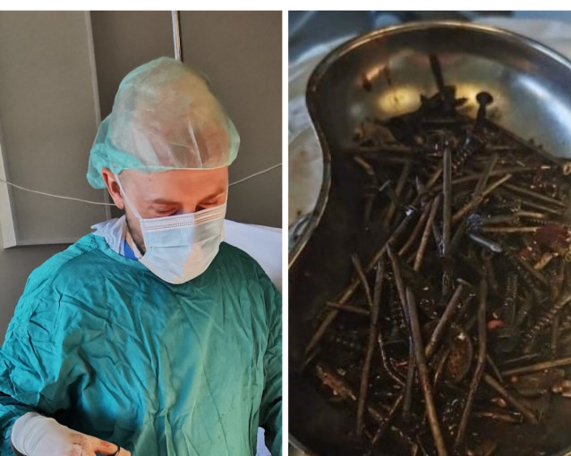 Unikalus atvejis Klaipėdos universitetinėje ligoninėje: iš skrandžio pašalinta per kilogramą svetimkūnių
